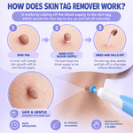 Auto Skin Tag Remover