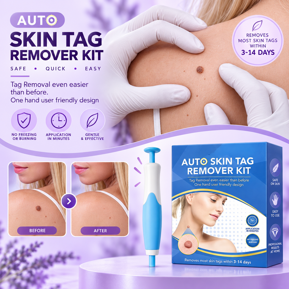Auto Skin Tag Remover