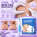 Auto Skin Tag Remover